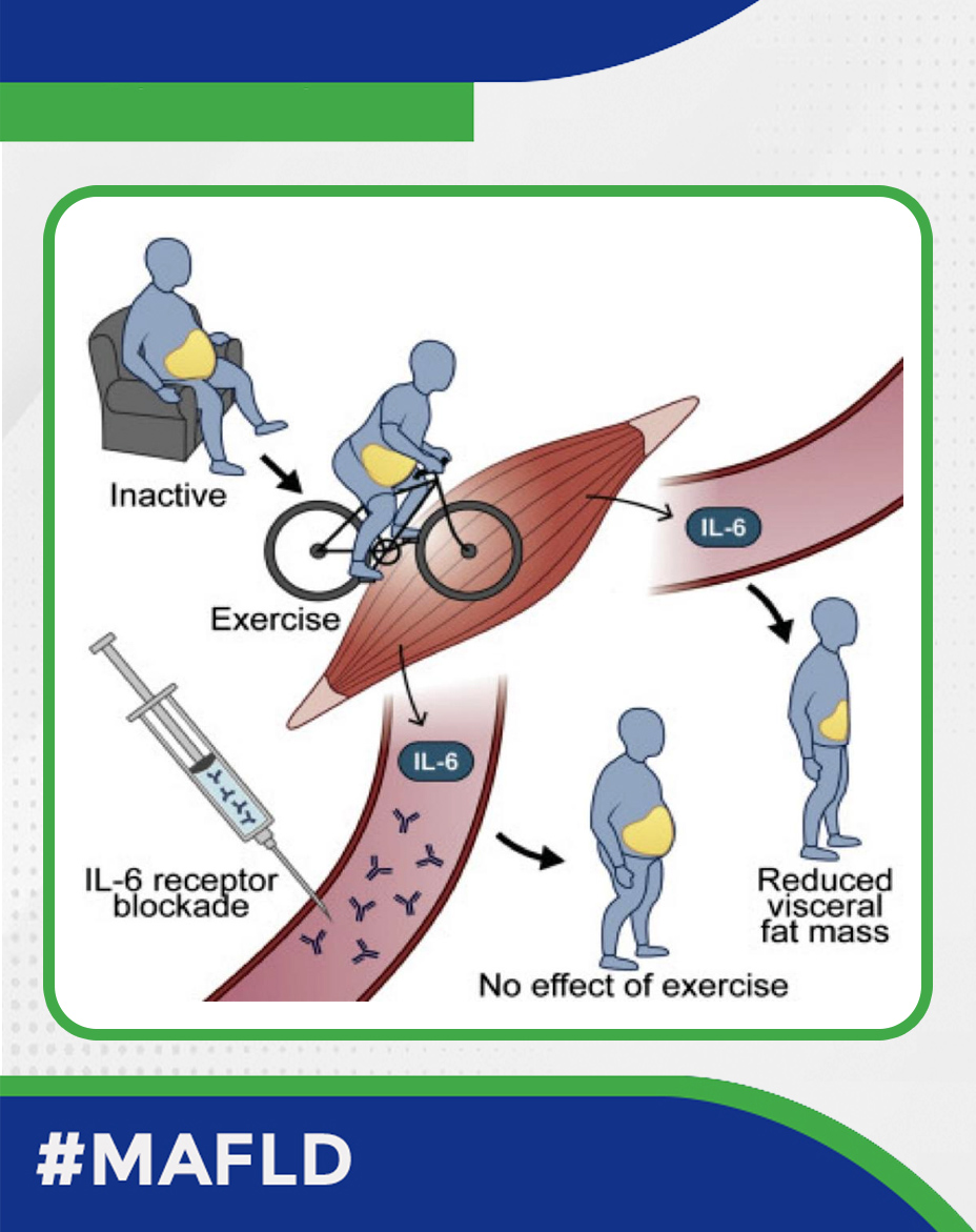 Exercise-Induced Changes in Visceral Adipose Tissue Mass (VATM)

✅Exercise reduces VATM
✅Loss of VATM following exercise is dependent on IL-6
✅Improvements in cardiorespiratory fitness following exercise are not IL-6 dependent. 
👉shorturl.at/yVW9y
#MAFLD #Livertwitter