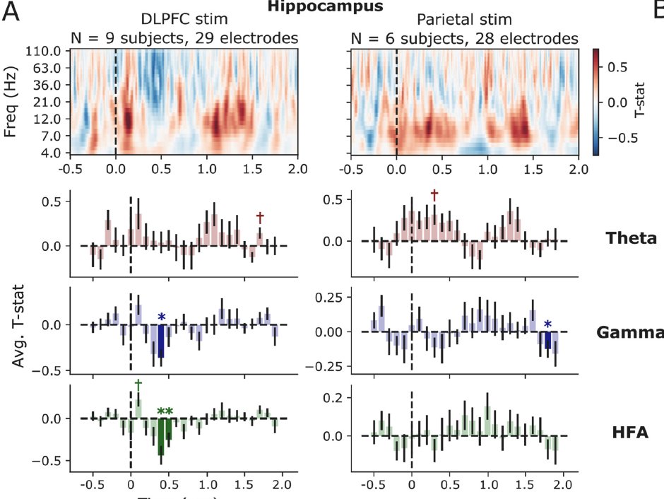 esolomon's tweet photo. 5/ TMS to the posterior parietal cortex -- specifically targeted to regions with maximal functional connectivity to the hippocampus -- caused increases in MTL/hippocampal theta power, while DLPFC stim caused decreases in hippocampal gamma power. https://t.co/vtYlv2Sv3K