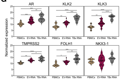 quimmateo's tweet photo. New paper from the lab @VHIO is out in @Cancer_Cell: dual DNA/mRNA profiling from circulating EVs in #prostatecancer liquid biopsies
Team-science work led by our own @ICasanovaSalas 
https://t.co/k4IDJRtcE1 https://t.co/BobiB1l3pc