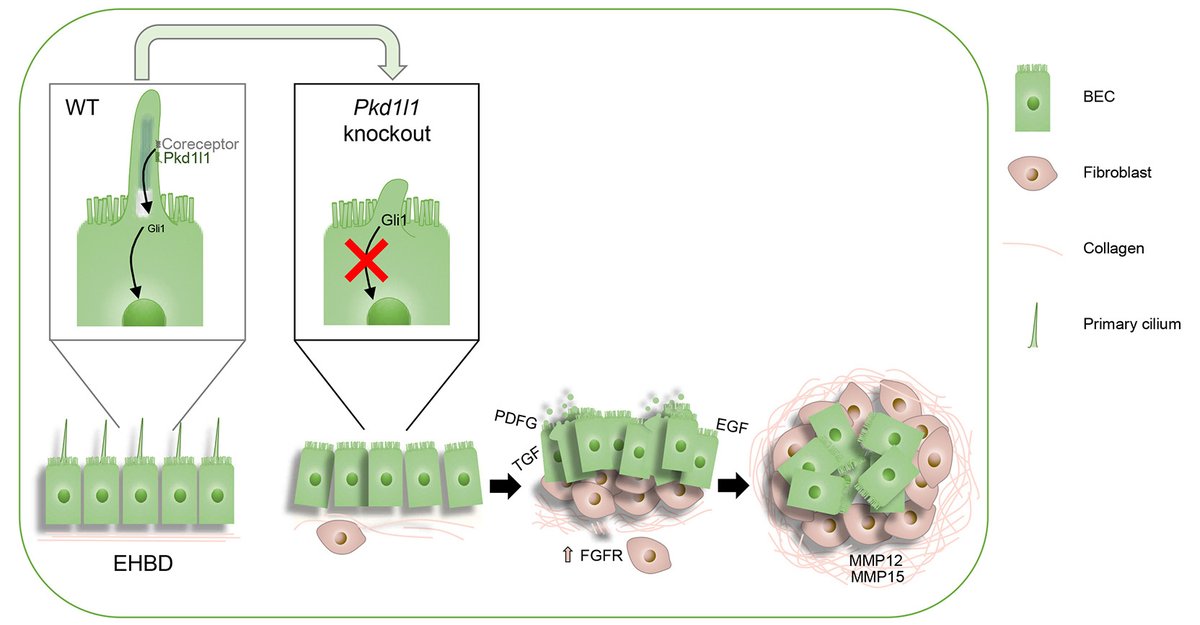 Children’s Research Institute at UT Southwestern (@cri_utsw) on Twitter photo (1/2) IN PRINT now (ICYMI) <a href="/JHepatology/">Journal of Hepatology</a>: CRI's <a href="/Zhu_Lab/">Hao Zhu Lab</a> & <a href="/DrDrNatasha/">Natasha Corbitt</a> continue to dig into causes of biliary atresia — a rare pediatric liver disease that affects ~1 in 12,000 U.S. infants. journal-of-hepatology.eu/article/S0168-… #relentlessdiscovery #womeninSTEM (1/2) IN PRINT now (ICYMI) <a href="/JHepatology/">Journal of Hepatology</a>: CRI's <a href="/Zhu_Lab/">Hao Zhu Lab</a> & <a href="/DrDrNatasha/">Natasha Corbitt</a> continue to dig into causes of biliary atresia — a rare pediatric liver disease that affects ~1 in 12,000 U.S. infants. journal-of-hepatology.eu/article/S0168-… #relentlessdiscovery #womeninSTEM
