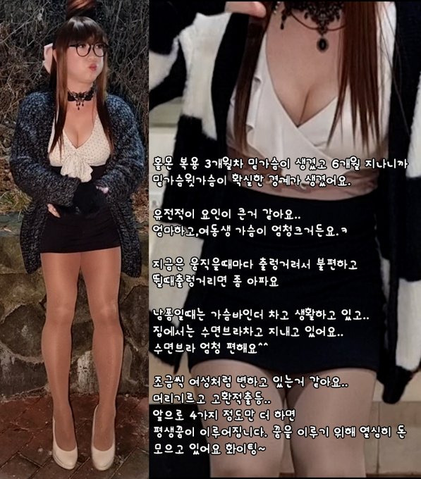 홀몬 복용 3개월차 밑가슴이 살짝 생겼고 6개월 지나니까 . 밑가슴윗가슴이 확실히 생겼어요  지금은 움직을때마다 출렁거려서 불편하고 뛸때출렁거리면 좀 아파요  이제 항상 브레지어 차고<a href="/tag/mvsales"class="tags"><span>#mvsales</span></a>