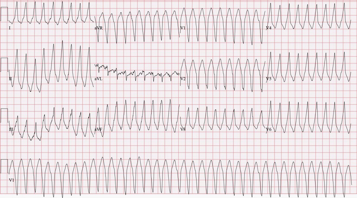 Sam Ghali, M.D. tweet media