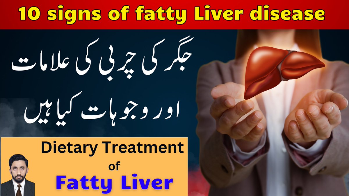 MedguideMSaeed's tweet photo. Causes and Symptoms of Fatty Liver Disease | Dr Mudasir Saeed

Fatty liver disease (FLD)

#FattyLiverDisease
#FattyLiverSymptoms
#FattyLiverCauses https://t.co/lB6upm03b4