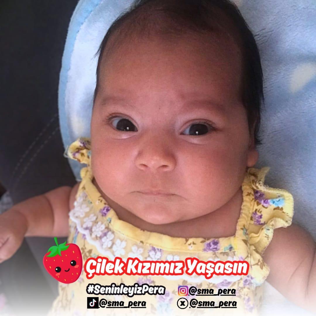#seninleyizpera
#smadegilperakazanacak 🍓🍓