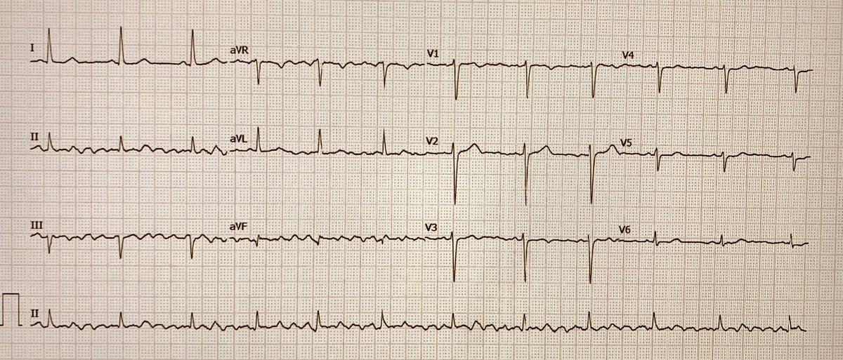 Rodrigo Isa Param tweet media