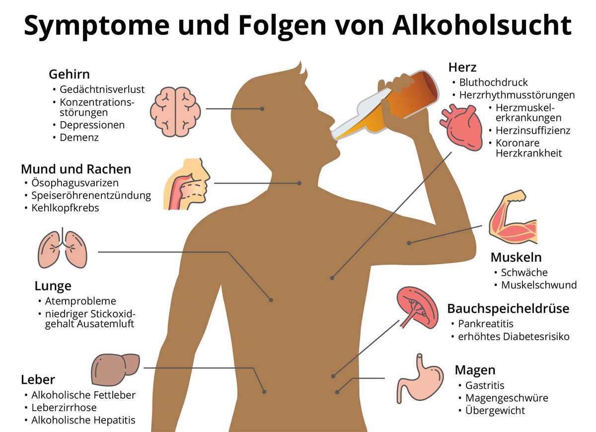<a href="/stephanpalagan/">Stephan Anpalagan</a> Legen wir an den #Alkoholkonsum die gleichen Maßstäbe wie bei #Cannabis zugrunde, müssen <a href="/cducsubt/">CDU·CSU</a> für ein sofortiges #Alkoholverbot eintreten!
Wenn sie denn ehrlich genug wären?

Alkohol - Die geschützte Droge
deutschlandfunk.de/alkohol-die-ge…