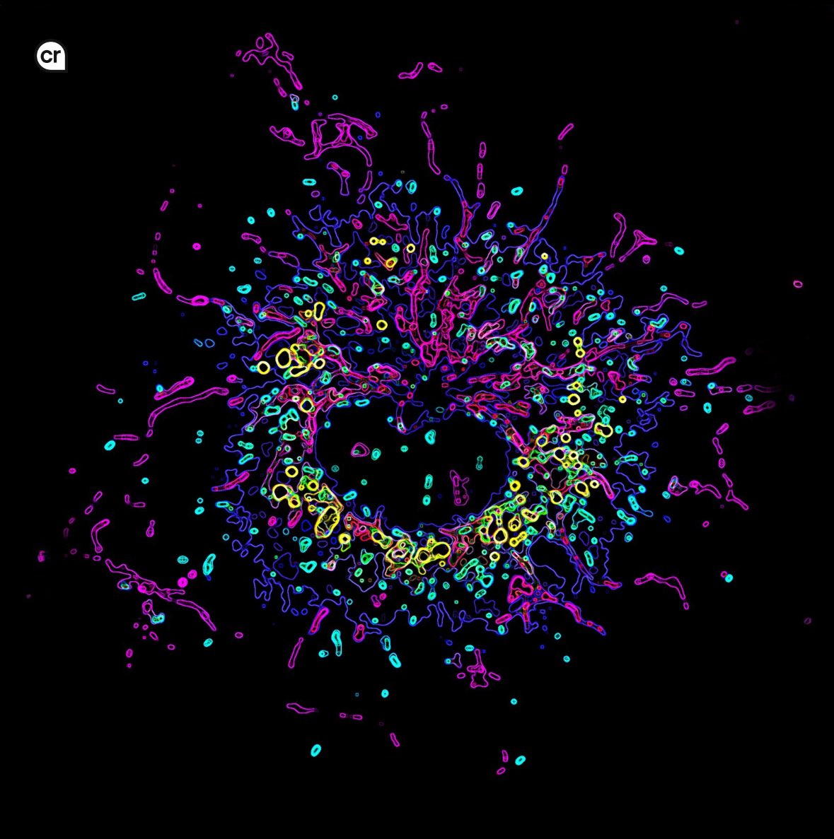 Uri Manor 💔 (@manorlaboratory) on Twitter photo Lovely new paper and method from my old <a href="/JLS_Lab/">Lippincott-Schwartz Lab</a> colleague Angelika Rambold investigating inter-organelle signaling Lovely new paper and method from my old <a href="/JLS_Lab/">Lippincott-Schwartz Lab</a> colleague Angelika Rambold investigating inter-organelle signaling