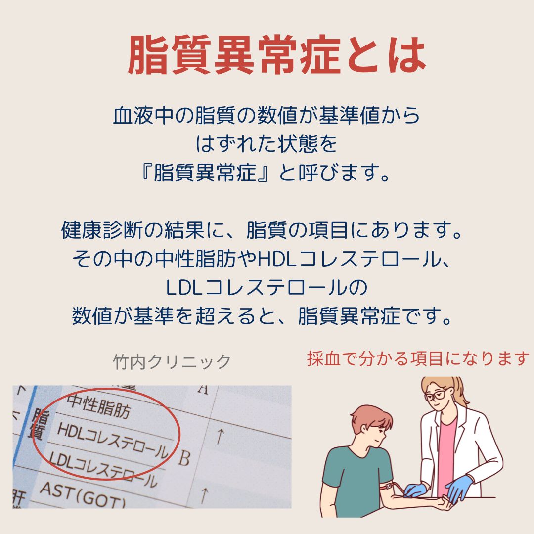 chitatakeuchi's tweet photo. 健康診断で再検査になりやすい脂質異常症。  脂質異常症は自覚症状が少ないのですが、動脈硬化が進行して、高血圧や心筋梗塞、脳卒中など様々な病気を引き起こします。  竹内クリニックでは、一人一人の病気やリスクに応じて、医師が適切なお薬を選択しています。

#生活習慣病 #コレステロール https://t.co/9POFzGLyyo