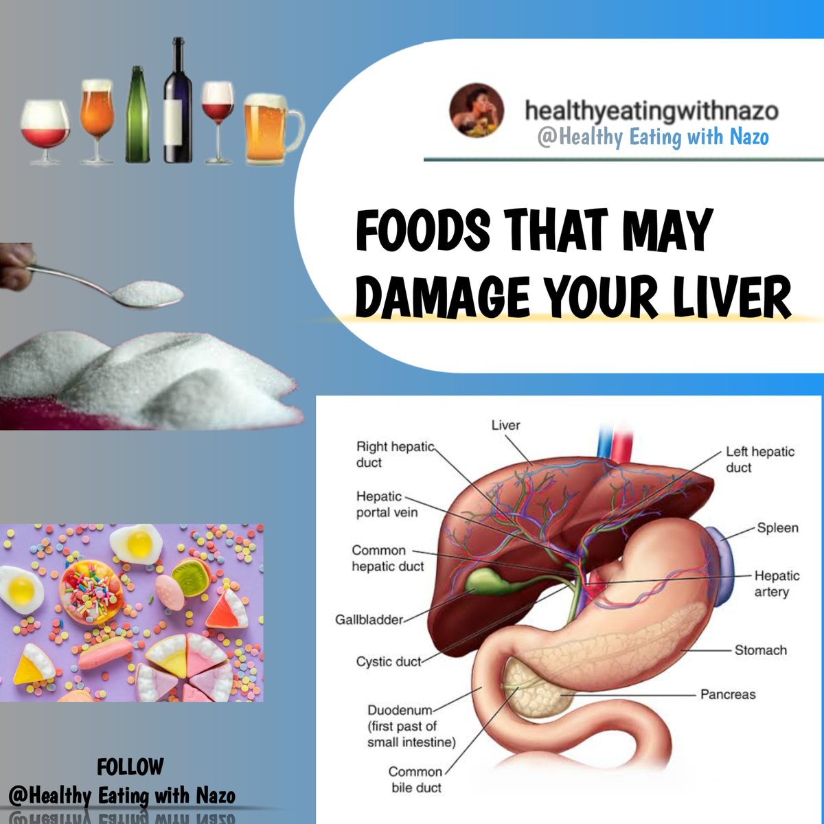 EATINGWITHNAZO's tweet photo. What foods damage your LIVER?

Several foods can potentially damage your LIVER if consumed in excess or if you have underlying LIVER conditions. Here are some foods that you should be cautious about.

🎯BE YOUR BROTHERS KEEPER 
🎯REPOST FOR OTHERS 

A MUST READ THREAD 👇 https://t.co/VQDA0rLuZ2