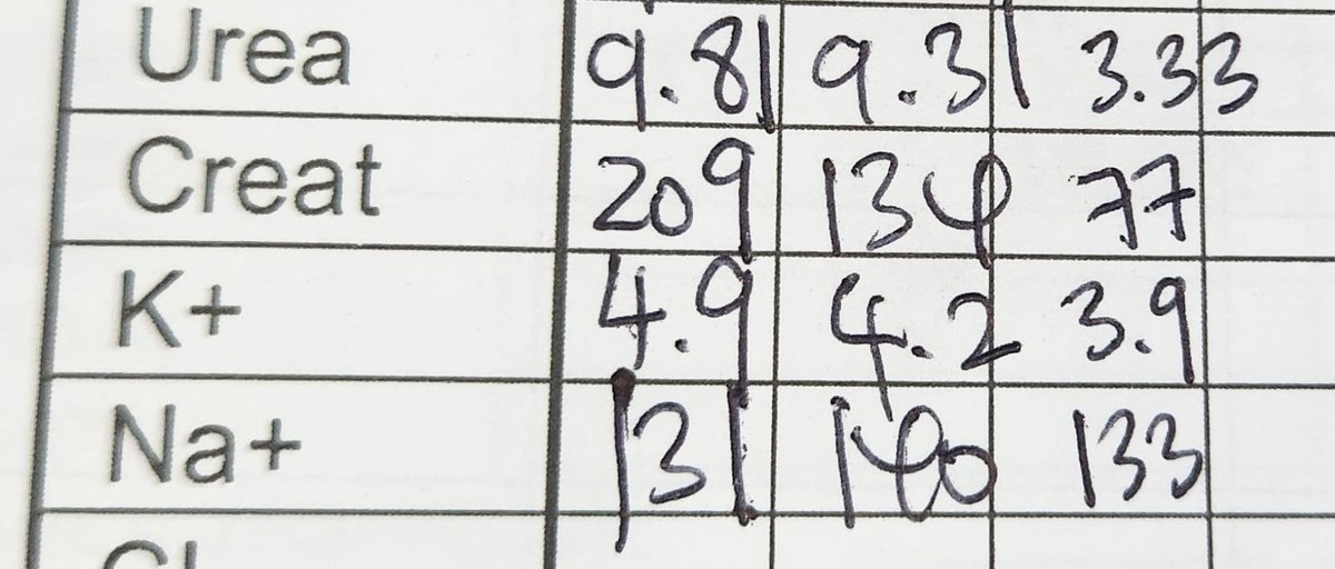 nabilazzhar's tweet photo. Those who overclaim suka guna result begini claim Creatinine drop drpd 209 ➡️ 77.

Kidney deteriorate in 2 ways, ACUTE or CHRONIC.

Baseline Creatinine last year: 80

Upon this admission, rise up to 209. On proper hydration, renal improving.

Does he need RM14k for reverse CKD? https://t.co/AnA0zQw766