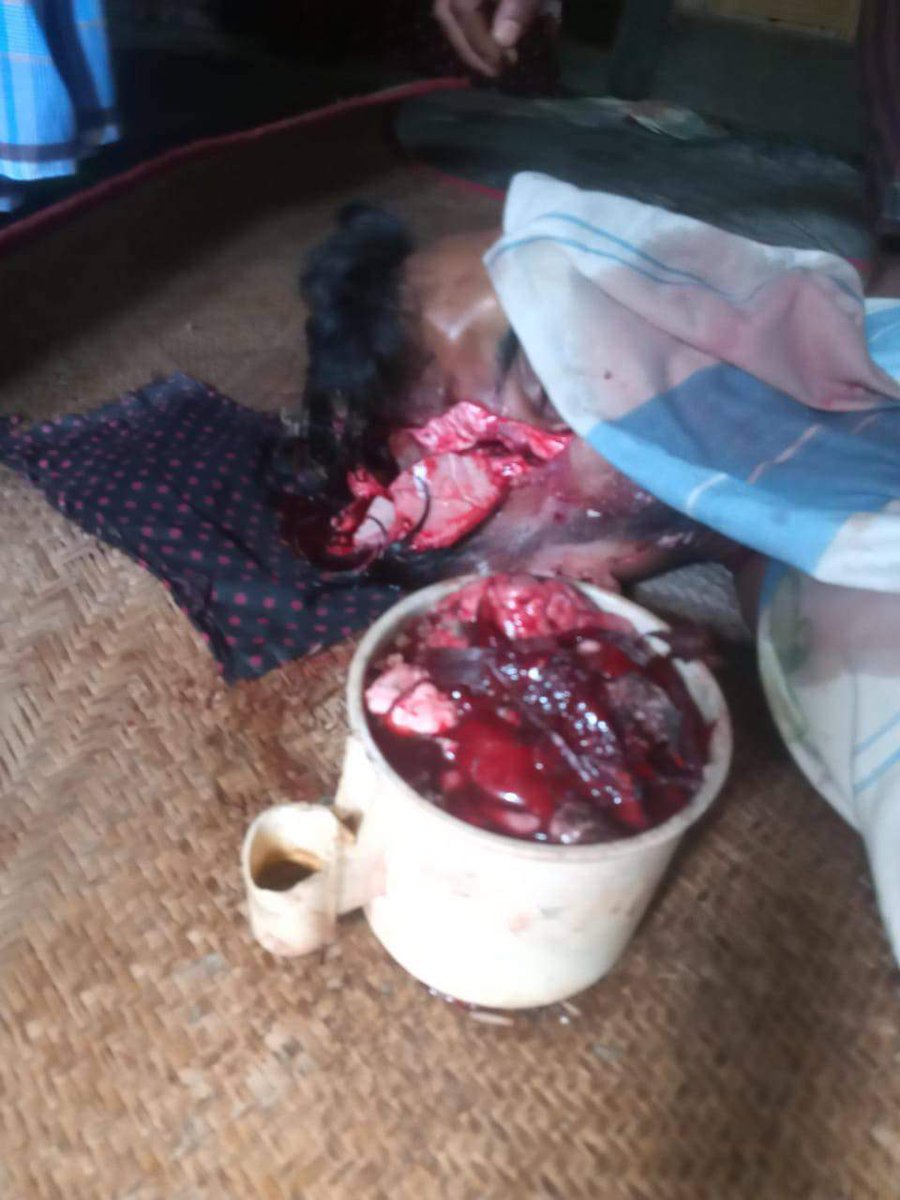 SweRohingya's tweet photo. A very tragic incident occurred today in Ward 1, Maungdaw.A Rohingya lost his life &amp; over 10 others injured in a deliberate drone attack by Rakhine militant group, Arakan Army.The situation remains volatile and calls for urgent attention to prevent further loss of innocent life https://t.co/kCEzyn2okJ