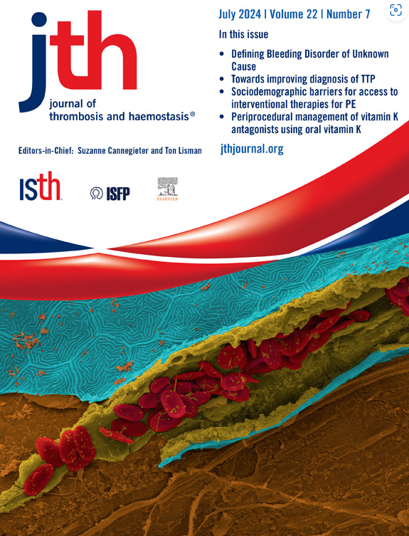 JTH (@jthjournal) on Twitter photo Their data indicate that fibrin clots can form in vivo in the absence of blood cells.
<a href="/Clot1/">Jordan Shavit</a>
@MHolinstat
<a href="/Gr8LakesWetLab/">K Keeler</a>
<a href="/UMich/">University of Michigan</a>
<a href="/UMichResearch/">Michigan Research</a>
<a href="/umichCVC/">U-M Health Frankel CVC</a>
<a href="/umichmedicine/">Michigan Medicine</a>
jthjournal.org/article/S1538-… Their data indicate that fibrin clots can form in vivo in the absence of blood cells.
<a href="/Clot1/">Jordan Shavit</a>
@MHolinstat
<a href="/Gr8LakesWetLab/">K Keeler</a>
<a href="/UMich/">University of Michigan</a>
<a href="/UMichResearch/">Michigan Research</a>
<a href="/umichCVC/">U-M Health Frankel CVC</a>
<a href="/umichmedicine/">Michigan Medicine</a>
jthjournal.org/article/S1538-…
