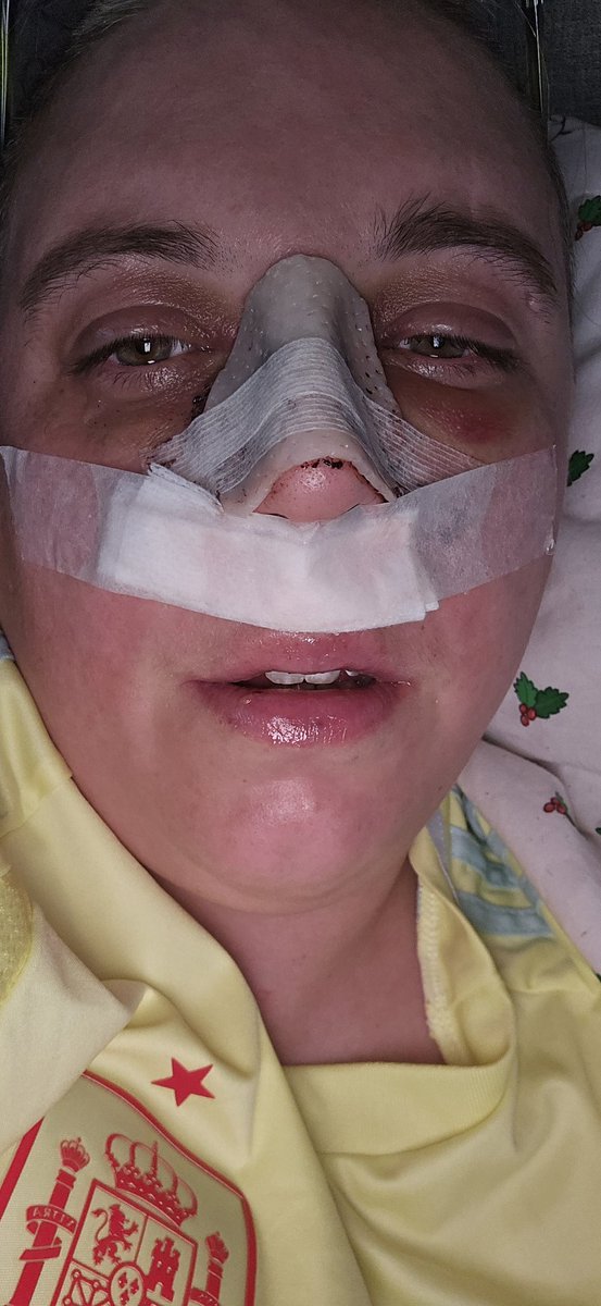 Tina_J_Anderson's tweet photo. So I've had surgery 
And top it off my mother had a fall and broken her neck 😞 bad year https://t.co/nAh1k7N1vg