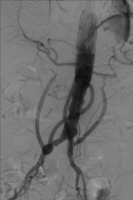 Dr Shivanesan Pitchai tweet media