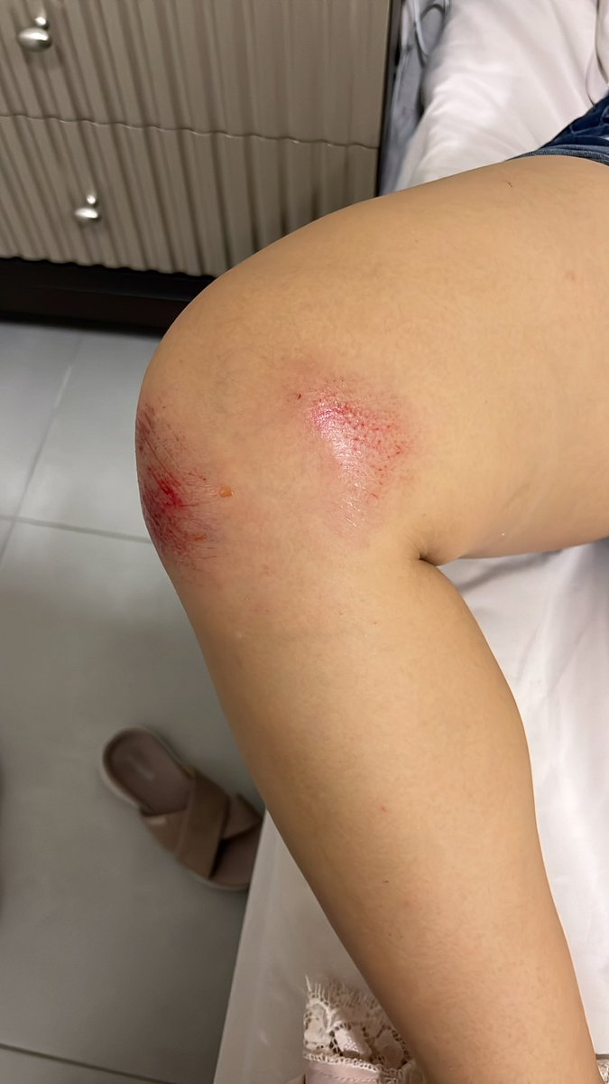 Hoy quiero compartir una experiencia preocupante que tuvimos mi esposa embarazada y yo en nuestra ciudadela “Residencias Vizcaya” de constructora SOLINES en Ciudad Celeste. 
La mala administración han creado condiciones inseguras para los residentes y visitantes.