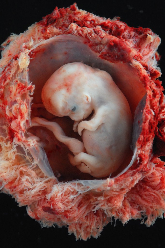 LindaMu38317430's tweet image. Psalm 1:39
 'I knit you together in your mothers womb. Your days were written before you. I knew you in that special place' 
#ProLife 
#ProGod