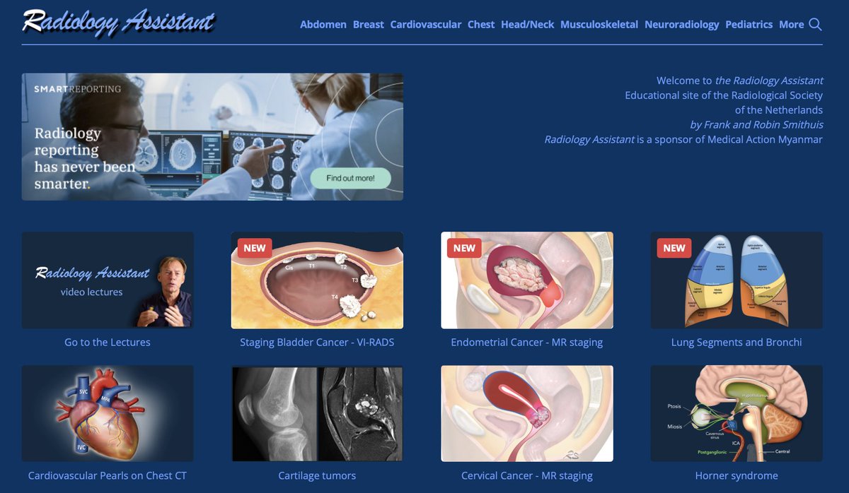 Ailin Dehghanpour (@ailinradio) on Twitter photo I am beyond excited and humbled to share the new page on VI-RADS on the well known educational website of Radiology Assistant. Thanks to <a href="/IvoSchootsNL/">Ivo Schoots</a>, Robin Smithuis and <a href="/VPanebiancoIT/">Valeria Panebianco</a>
radiologyassistant.nl/abdomen/bladde… I am beyond excited and humbled to share the new page on VI-RADS on the well known educational website of Radiology Assistant. Thanks to <a href="/IvoSchootsNL/">Ivo Schoots</a>, Robin Smithuis and <a href="/VPanebiancoIT/">Valeria Panebianco</a>
radiologyassistant.nl/abdomen/bladde…