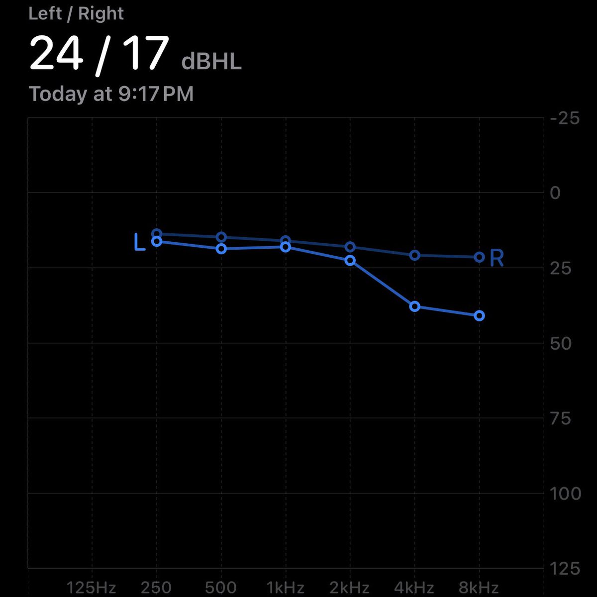 Ash_Jenks's tweet photo. My hearing is nearly fully back in my left ear after it ruptured just over a month ago! Soon won’t have any excuses for not hearing my partner 😅 @mimihearing https://t.co/xoIZv8Y5cu