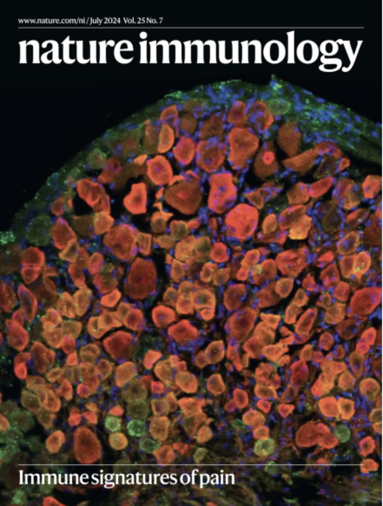 Aakanksha Jain (@aakanksha__jain) on Twitter photo Check out our recent work <a href="/NatImmunol/">Nature Immunology</a> highlighting how every pain condition is different, and immune cells might hold the key to these differences. As a cherry on top, our DRG image was chosen as the cover art 😃
P.C. <a href="/sarainthelab/">Sara Hakim</a>
nature.com/articles/s4159… Check out our recent work <a href="/NatImmunol/">Nature Immunology</a> highlighting how every pain condition is different, and immune cells might hold the key to these differences. As a cherry on top, our DRG image was chosen as the cover art 😃
P.C. <a href="/sarainthelab/">Sara Hakim</a>
nature.com/articles/s4159…