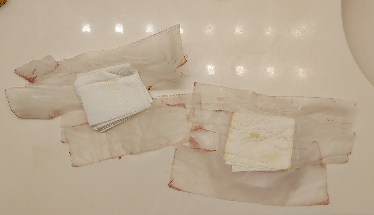 As of today, I have no drains, or bandages, or tubes, or leads, or doo-hickies, or whatchamathingies, or anything else hanging off me or attached to me. I feel free!! 🤩🙏🏻💃🏼✨️🎊

#grateful #gratitude #MedicalProcedures