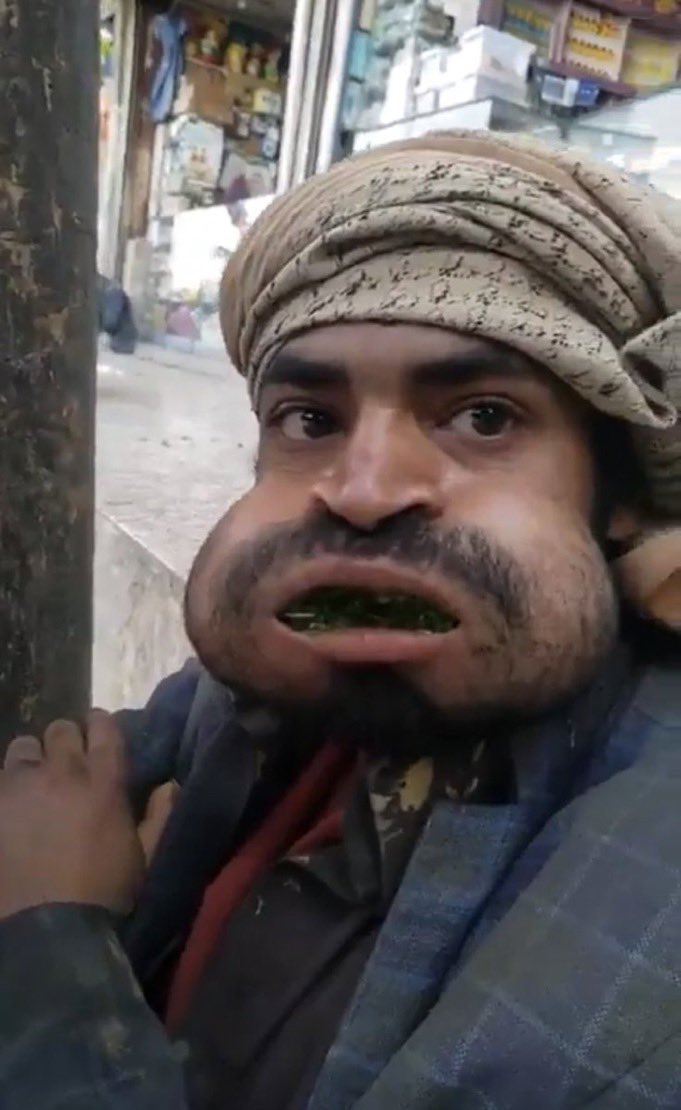 𝓗𝓐𝓣𝓣𝓐𝓝 tweet media