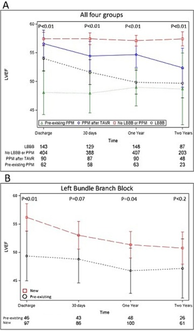 Just accepted in <a href="/CRMjournal/">CRMjournal</a>+<a href="/ELS_Cardiology/">Elsevier Cardiology</a>!

Impact of #LBBBor permanent #PPM after #TAVR #TAVI on mid-term #LVEF by <a href="/IlanMerdler/">Ilan Merdler</a> <a href="/BCase07/">BCaseMD</a> <a href="/KalChitturi/">Kalyan Chitturi</a> <a href="/DorBen/">Itsik Ben Dor</a> <a href="/ronwaksman/">ron waksman</a> et al.

clinicalkey.com/#!/content/pla…