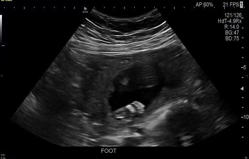 AceDolo 🇵🇦 tweet media