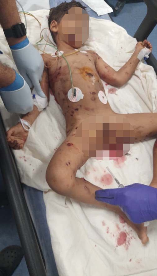 gundemedairhs's tweet photo. BÜTÜN ÇOCUKLAR KÖPEKLER TARAFINDAN PARÇALANANA KADAR BU UMURSAMAZLIK DEVAM MI EDECEK?

Adana'da başıboş köpeklerin saldırısına uğrayan 5 yaşındaki Abbas Haşmet, ağır yaralandı.