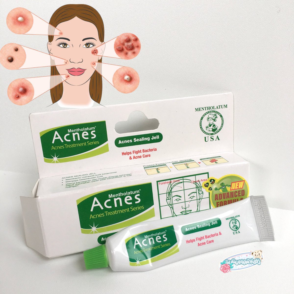 jrubyjuwi's tweet image. ✨Menemukan obat totol jerawat yang murah 🥹 dan cepet banget keringnya ✨
#ByJuwi 

Sebel banget kalau tiba" ada jerawat muncul, padahal mau pergi di minggu yang sama. Bingung gimana ngatasinnya... 

Tapi sekarang aku menemukan obat totol jerawat yang bener" ajaib😍