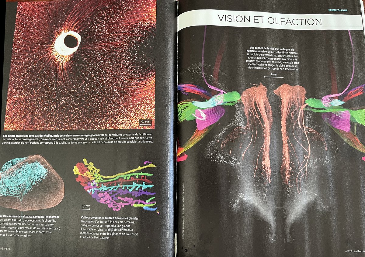 Alain Chédotal (@alainchedotal) on Twitter photo Merci à <a href="/maglarecherche/">La Recherche</a> pour ce portfolio estival qui met en valeur une sélection de nos images d’embryons
<a href="/AnanasOjus/">Anaïs Favre🍍🔬</a> Raphael Blain <a href="/amin_benadjal/">Amin Benadjal</a> Merci à <a href="/maglarecherche/">La Recherche</a> pour ce portfolio estival qui met en valeur une sélection de nos images d’embryons
<a href="/AnanasOjus/">Anaïs Favre🍍🔬</a> Raphael Blain <a href="/amin_benadjal/">Amin Benadjal</a>