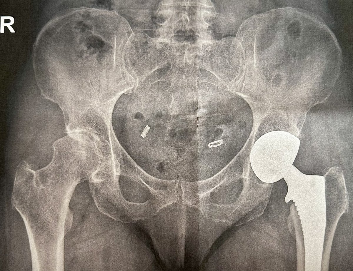 DrWEI_EU's tweet image. #postoperation patient receiving #treatment from #acupuncture #acupressure #lyimpact .