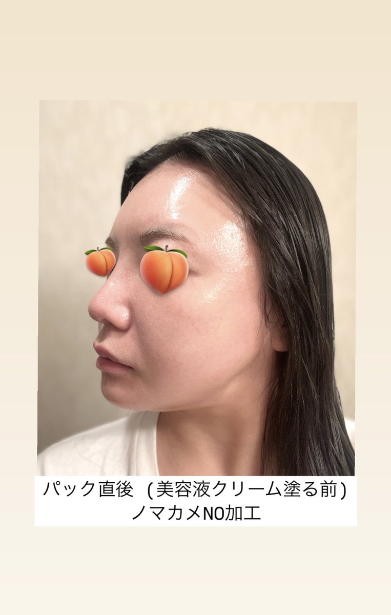 anchandesu_dk's tweet photo. 24H限定セールだから今すぐシェア‼️美容ｸﾘﾆｯｸ勤務の韓国ｵﾝﾆに紹介してもらってからもうリピ3つ目のCICIBELLA(シシベラ)のシートマスク🪄︎︎◝✩私はメガ割よりも安い楽天のこの690円セールをいつも狙って買ってるദ്ദി⟡灼熱のタイ旅行でも大活躍したよｗ化粧ノリ◎トーンアップ◎ハリ・ツヤ◎ https://t.co/WKPAW1R3Nd