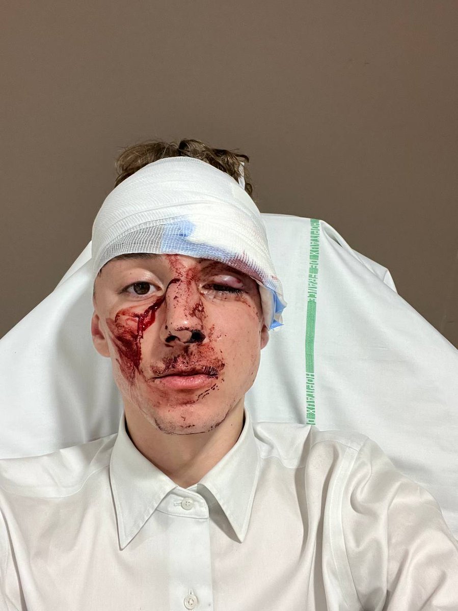 🚨 Des voyous dans la police "républicaine" ?

Un jeune insoumis qui manifestait pacifiquement hier à Lille après la victoire du Nouveau Front Populaire a été passé à tabac par la BAC.

Des mesures immédiates doivent être prises envers ces agents, avec des sanctions exemplaires.