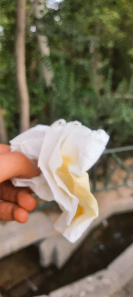 در ادامه پیاده‌روی‌هام امروز به محض رسیدنم به لوکیشن، یه پرنده زحمت کشید دقیقا روی فرق سرم کارخرابی کرد. خیلی هم دلش پر بود. کلی توی پارک سرم رو شستم. بعدش که با دستمال خشک کردم دستمال هم رنگی شد. کارد می‌زدن خونم در نمی‌اومد.😂 واقعا کاش می‌شد تلافی کرد:)