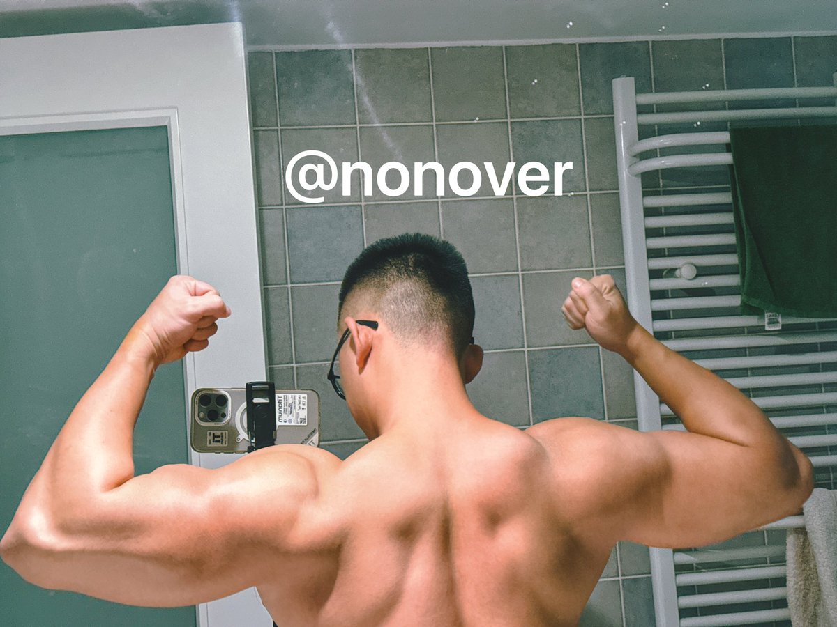 #树洞
悬着的心终于死了，不过已经很坦然接受一些结局
同时也不必瞒着大家，确实最近用了类固醇，已经不是自然的了，说出来心里好受多了