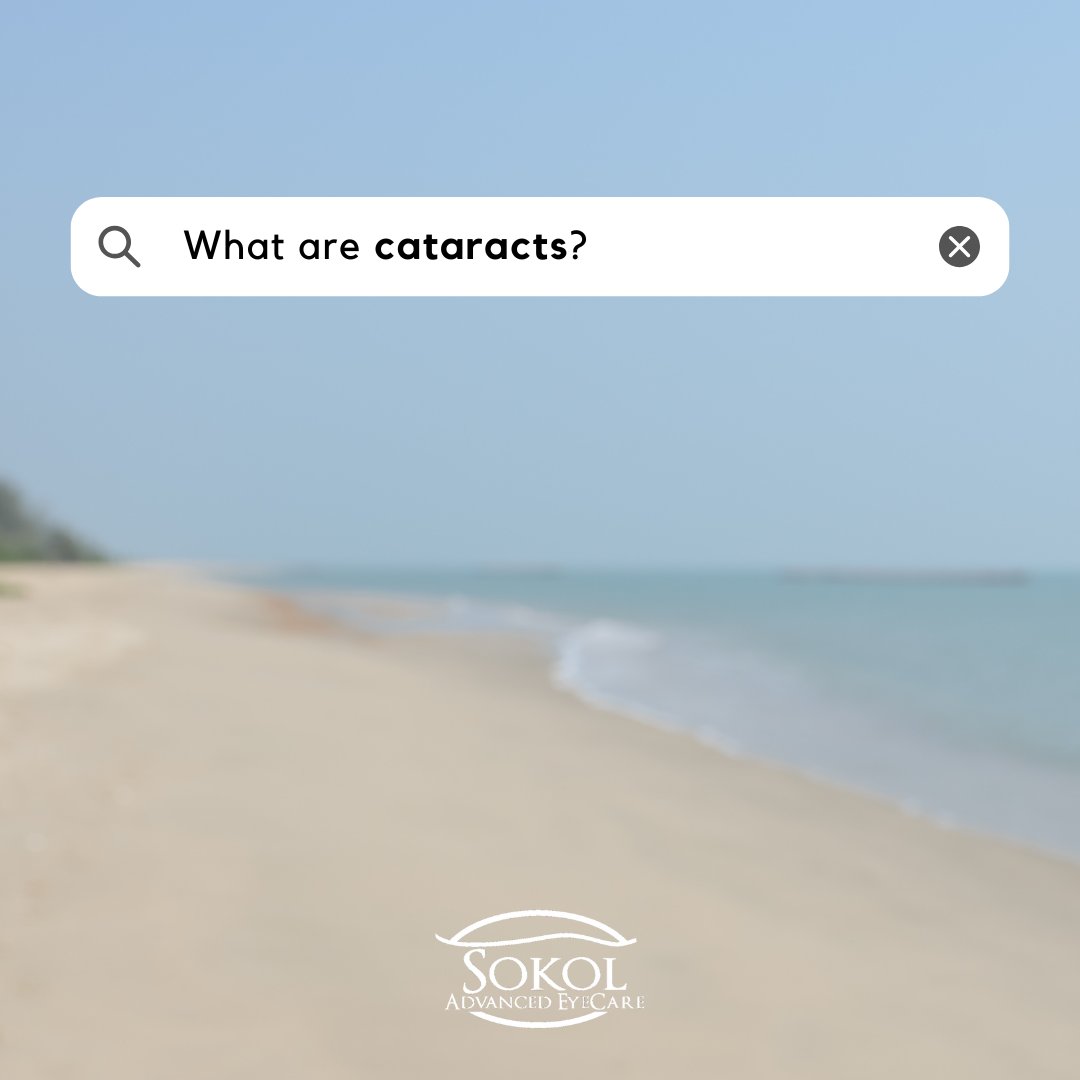 sokoleyecare's tweet image. 👁️ What are cataracts? They're a common eye condition causing cloudy vision, often linked to aging, smoking, and diabetes. Early detection through regular eye exams is crucial. Stay proactive about your eye health! #Cataracts #EyeHealth #SokolEyeCare #HealthyVision #EyeCareTips