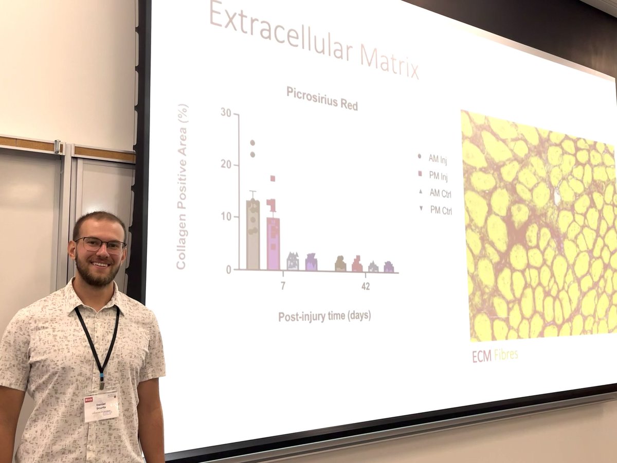 Matthew Krause (@matthewkrause01) on Twitter photo Dan Scurto <a href="/uwinkinesiology/">UWindsor Kinesiology</a> at #oep2024 presenting his findings on the effect of time of day (AM vs PM) on muscle damage repair outcomes. Dan Scurto <a href="/uwinkinesiology/">UWindsor Kinesiology</a> at #oep2024 presenting his findings on the effect of time of day (AM vs PM) on muscle damage repair outcomes.