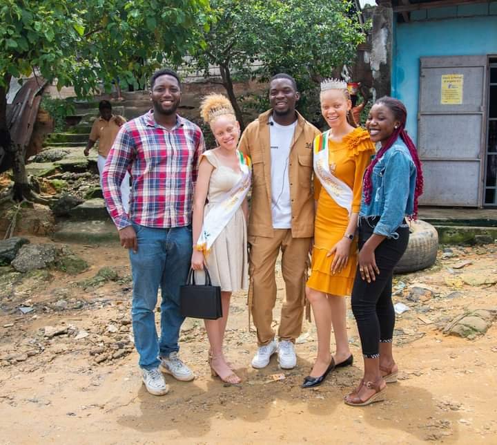Fabafriq's tweet image. and also to enjoy moments of joy and entertainment, while promoting the inclusion of Albino people in society.

#internationalalbinismawarenessday #integrity #sociallife #love #happiness #wearetogether #weareone #csractivity #fabafriqmediagroup #fabafriqmagazine