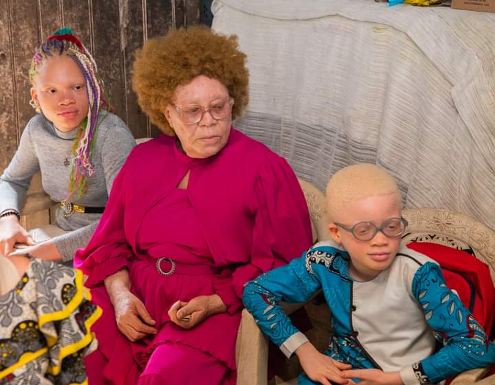 Fabafriq's tweet image. and also to enjoy moments of joy and entertainment, while promoting the inclusion of Albino people in society.

#internationalalbinismawarenessday #integrity #sociallife #love #happiness #wearetogether #weareone #csractivity #fabafriqmediagroup #fabafriqmagazine