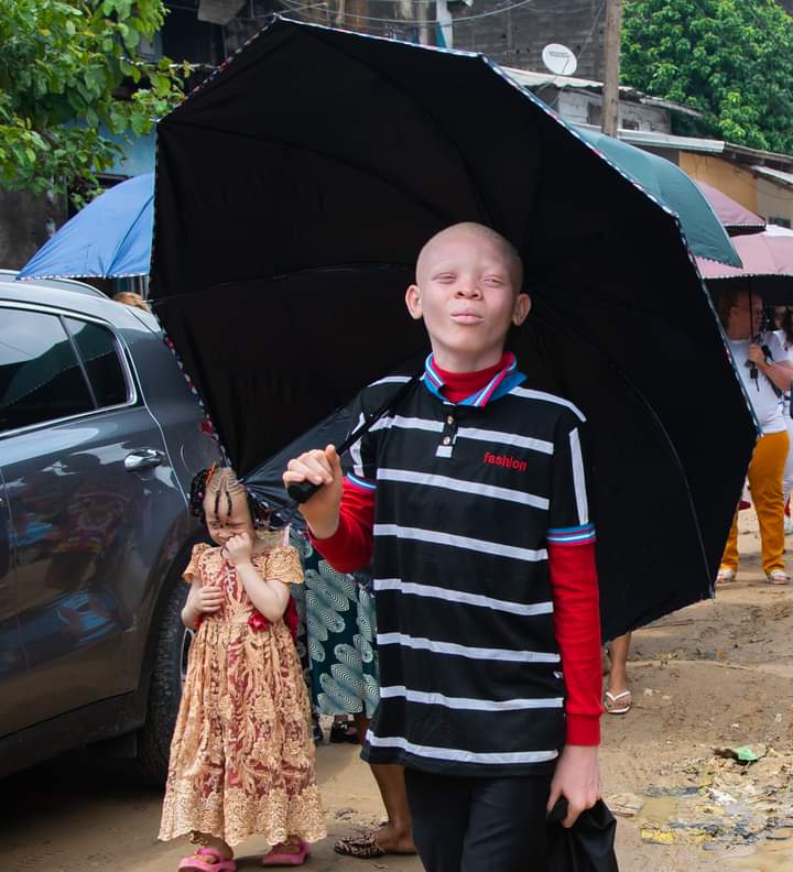 Fabafriq's tweet image. and also to enjoy moments of joy and entertainment, while promoting the inclusion of Albino people in society.

#internationalalbinismawarenessday #integrity #sociallife #love #happiness #wearetogether #weareone #csractivity #fabafriqmediagroup #fabafriqmagazine