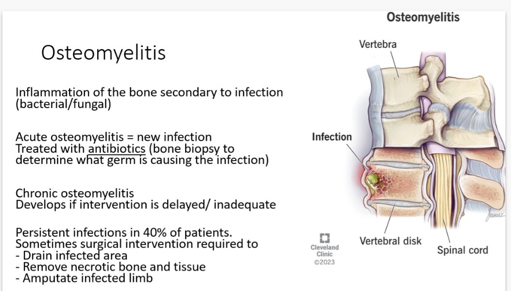 coop_ittbvh's tweet photo. Excellent presentation delivered today by our rotational physio, Frankie!
Increasing our knowledge about common conditions which present in patients and can affect therapy
๐๐
#PT #OT #commonconditions #therapy #careofolderperson #heartfailure #DVT #osteomyelitis #copd https://t.co/Y4nVrb1fY0