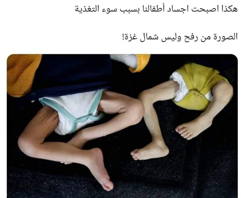 Mbdo95's tweet photo. بلادي كلها تموت جوعا

ليس الشمال فقط

لا أعلم ما أقوله https://t.co/U5hcWqI8Gc