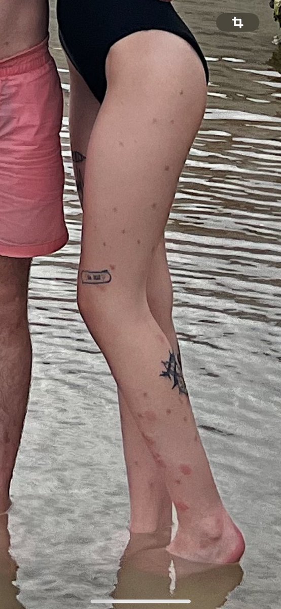 VegolasZer's tweet image. Venez on fait une trend : victimes des moustiques 🥸

J’ai un gros dossier encore sous la main !