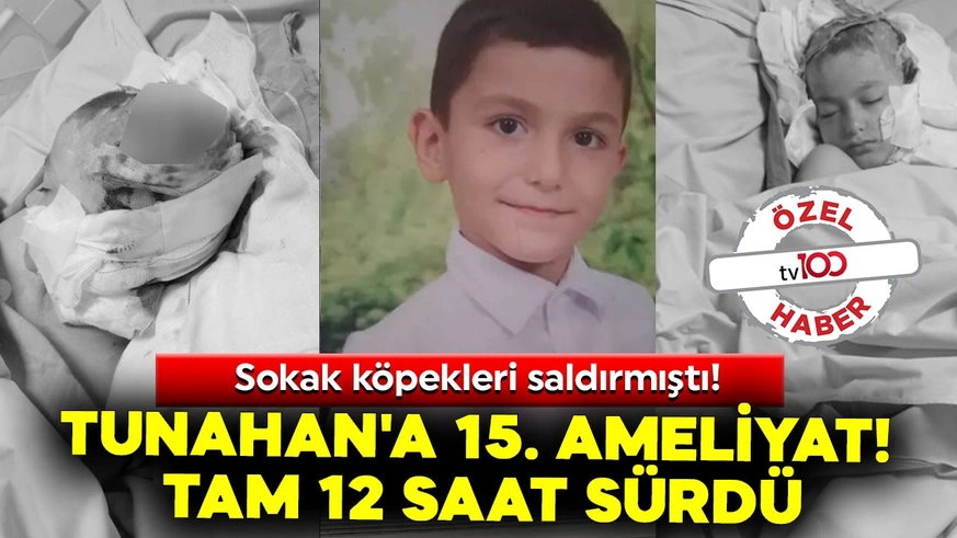 Sokak köpekleri saldırmıştı! Tunahan'a 15. ameliyat! Tam 12 saat sürdü!

tv100.com/sokak-kopekler…