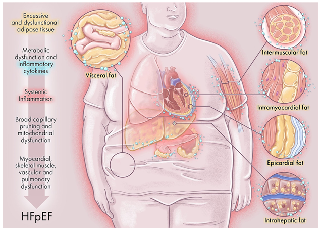 Andrew J Sauer MD tweet media