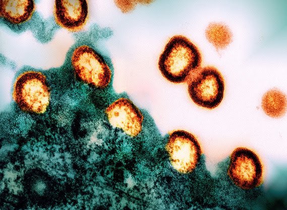 Alejandro Ferro (@doctorferro) on Twitter photo Fascinante estudio demuestra que la droga Lenacapavir del laboratorio <a href="/GileadSciences/">Gilead Sciences</a> administrada 2 veces al año resulta ser altamente eficaz para evitar la infección por VIH en mujeres <a href="/danielalvarez99/">Daniel Álvarez</a> <a href="/gabyazcoitia/">Gabriela Azcoitia</a> <a href="/marinaenrico/">Marina Enrico</a> <a href="/MartinSalaMdp/">Martín Sala</a> <a href="/FlorPalmieri/">Florencia Palmieri</a> <a href="/germanlagrasta/">Germán Lagrasta</a> Fascinante estudio demuestra que la droga Lenacapavir del laboratorio <a href="/GileadSciences/">Gilead Sciences</a> administrada 2 veces al año resulta ser altamente eficaz para evitar la infección por VIH en mujeres <a href="/danielalvarez99/">Daniel Álvarez</a> <a href="/gabyazcoitia/">Gabriela Azcoitia</a> <a href="/marinaenrico/">Marina Enrico</a> <a href="/MartinSalaMdp/">Martín Sala</a> <a href="/FlorPalmieri/">Florencia Palmieri</a> <a href="/germanlagrasta/">Germán Lagrasta</a>