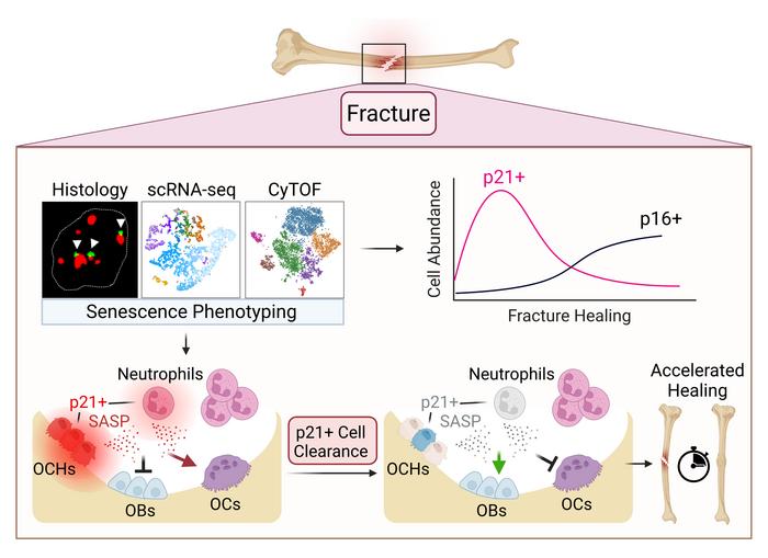Madison Doolittle (@madisondoolitt3) on Twitter photo New manuscript co-led with <a href="/skhosla78/">Sundeep Khosla</a> and the man himself <a href="/dominiksaul88/">Dominik Saul</a> where we define senescence in the healing fracture callus at the single-cell level! <a href="/MayoClinic/">Mayo Clinic</a> <a href="/jclinicalinvest/">Journal of Clinical Investigation</a>
jci.org/articles/view/… New manuscript co-led with <a href="/skhosla78/">Sundeep Khosla</a> and the man himself <a href="/dominiksaul88/">Dominik Saul</a> where we define senescence in the healing fracture callus at the single-cell level! <a href="/MayoClinic/">Mayo Clinic</a> <a href="/jclinicalinvest/">Journal of Clinical Investigation</a>
jci.org/articles/view/…