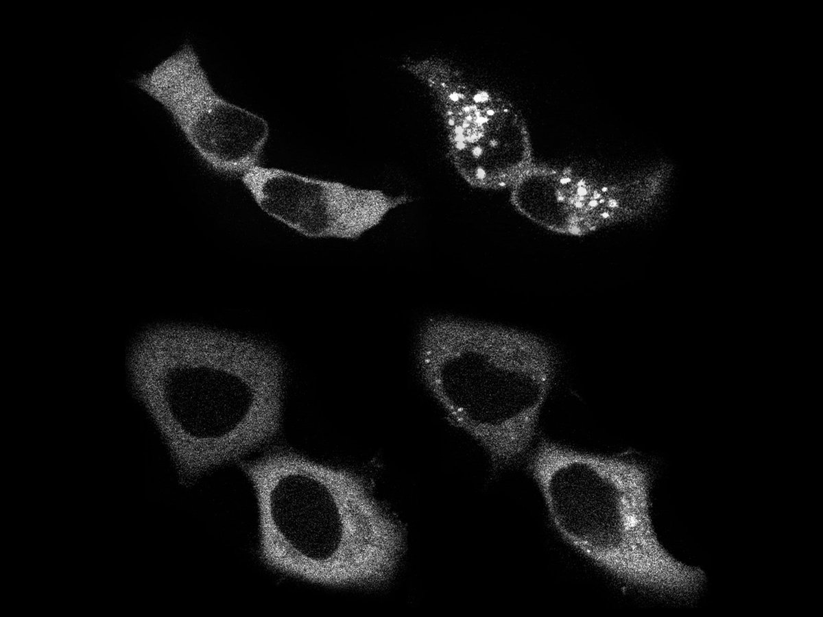 A new paper shows that the #endocytosis of #GPCRs such as AT1R can influence biased signaling through #BetaArrestin, suggesting the efficacy of beta-arrestin-binding ligands depends on spatial location as much as on receptor conformation. <a href="/semmelweishu/">Semmelweis University</a> scim.ag/7th