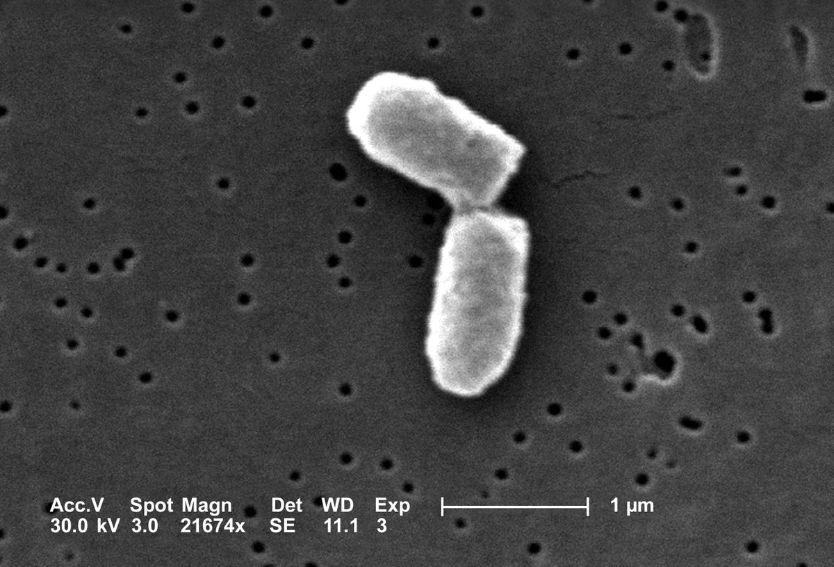 Niko McCarty 🧫 (@nikomccarty) on Twitter photo How to Engineer Cells to Grow Faster.
Yesterday <a href="/AsimovPress/">Asimov Press</a> published an essay about efforts to make microbes divide more quickly; ideally in a few minutes. (Human cells take many hours.)
But the essay was long (~5,000 words). Here is a summary. 🧵 How to Engineer Cells to Grow Faster.
Yesterday <a href="/AsimovPress/">Asimov Press</a> published an essay about efforts to make microbes divide more quickly; ideally in a few minutes. (Human cells take many hours.)
But the essay was long (~5,000 words). Here is a summary. 🧵
