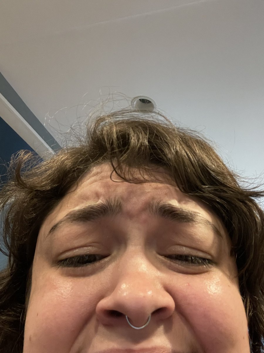 I’m getting a pimple right between my eyebrows